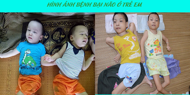 phuc-hoi-chuc-nang-tai-nha-thanh-nhan-quan-hai-ba-trung-ha-noi