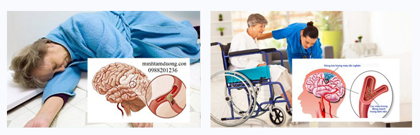 phuc-hoi-chuc-nang-tai-nha-bien-giang-quan-ha-dong-ha-noi phuc-hoi-chuc-nang-tai-nha-bien-giang-quan-ha-dong-ha-noi