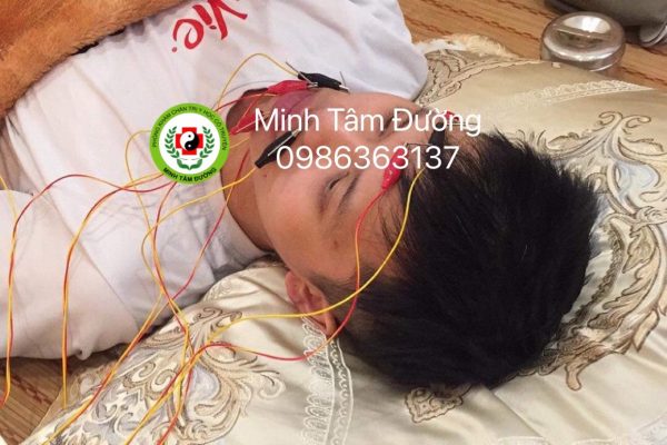 Châm Cứu, Bấm huyệt tốt nhất tại Nghĩa Tân, Cầu Giấy Châm Cứu, Bấm huyệt tốt nhất tại Nghĩa Tân, Cầu Giấy