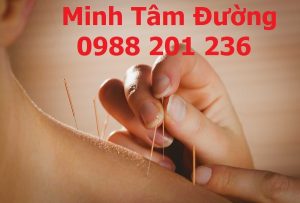 dich-vu-cham-cuu-tai-nha-nga-tu-so-dong-da-ha-noi