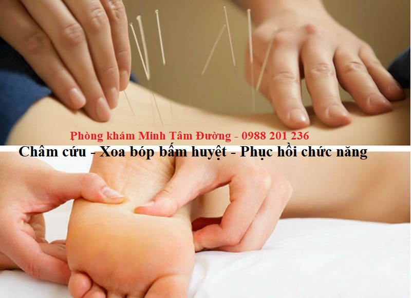 dich-vu-cham-cuu-tai-nha-trung-liet-dong-da-ha-noi