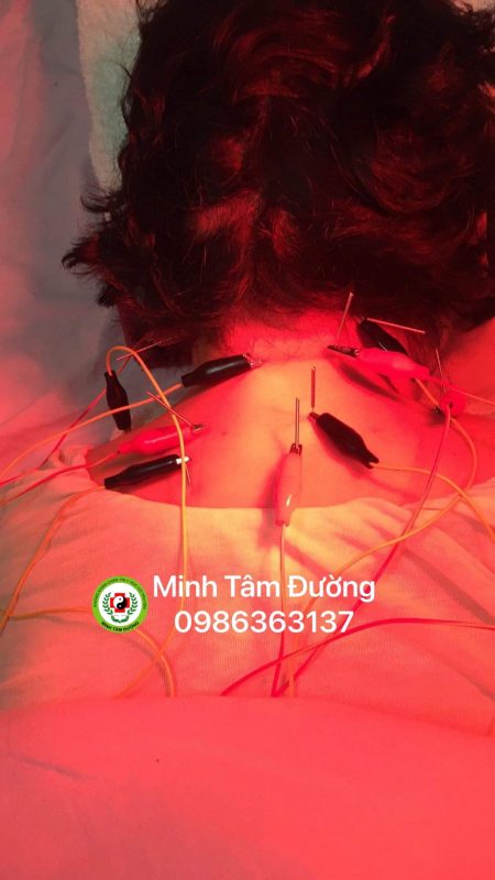 ham-cuu-tai-nha-tai-dinh-cong-hoang-mai ham-cuu-tai-nha-tai-dinh-cong-hoang-mai