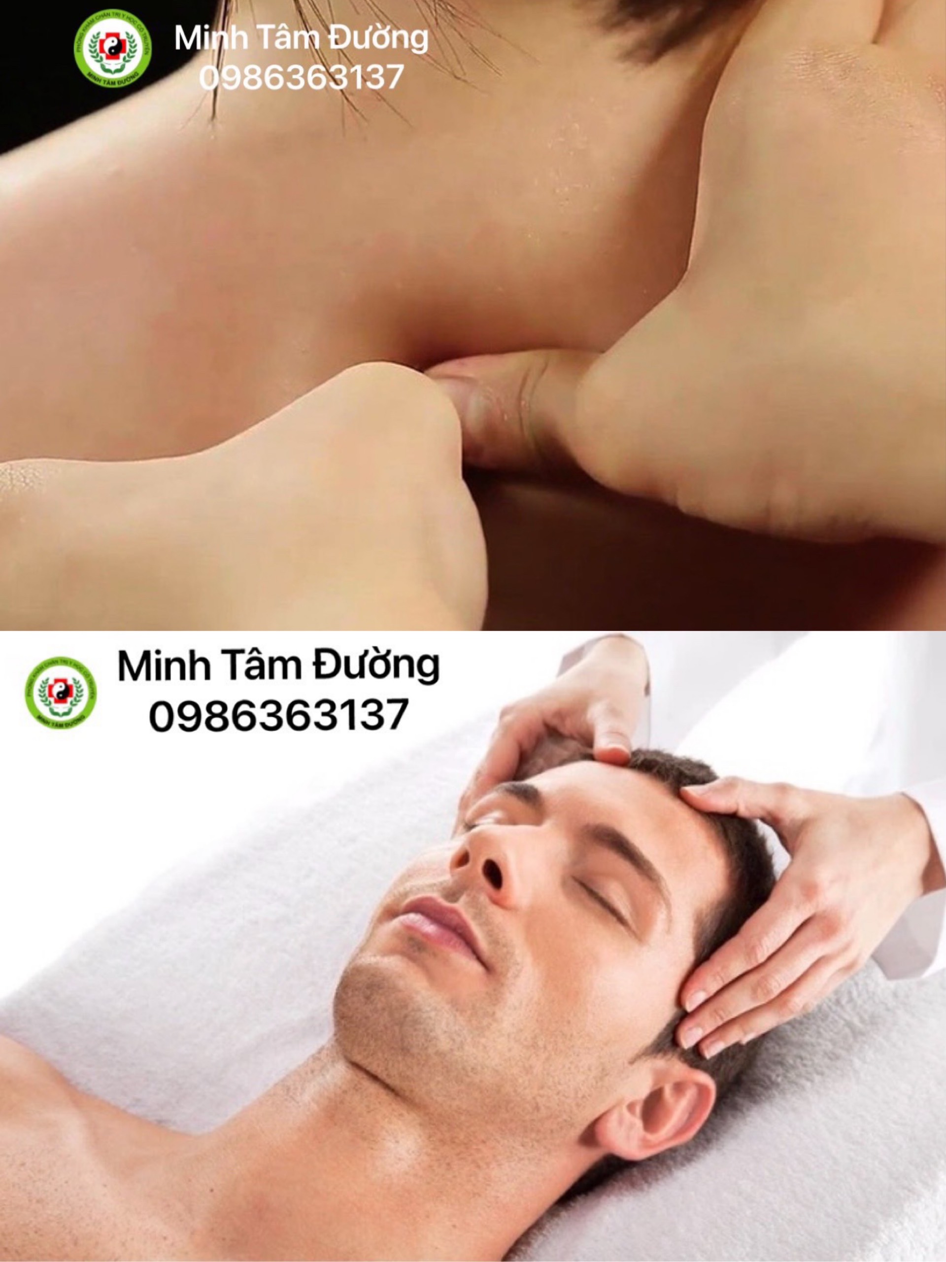 bam-huyet-tai-nha-tai-thuong-dinh