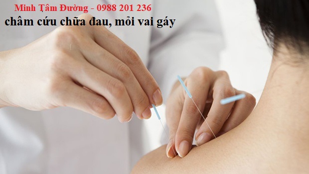 dich-vu-cham-cuu-tai-nha-phuong-lien-dong-da-ha-noi