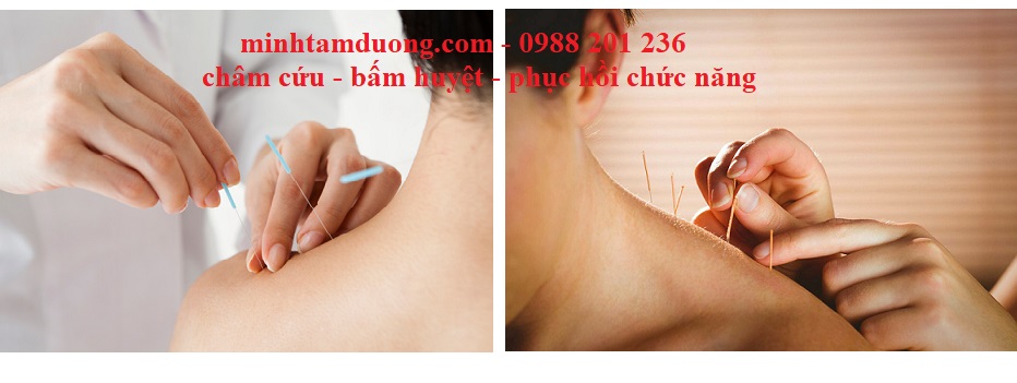 dich-vu-cham-cuu-tai-nha-van-mieu-dong-da-ha-noi