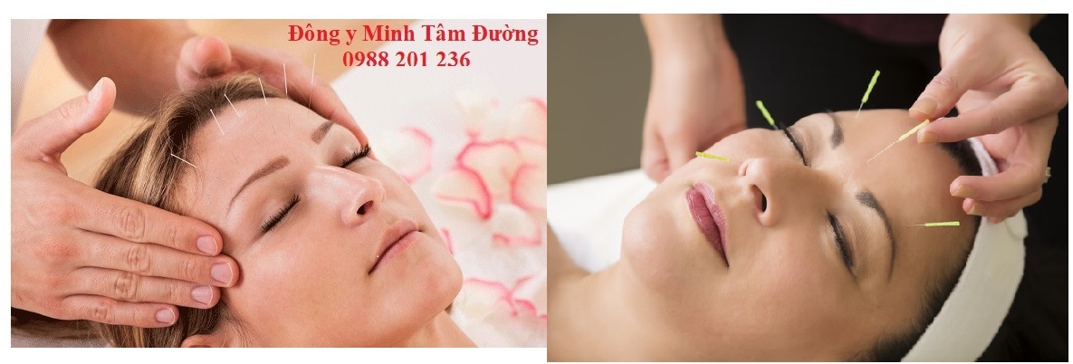 dich-vu-cham-cuu-tai-nha-cua-dong-hoan-kiem-ha-noi
