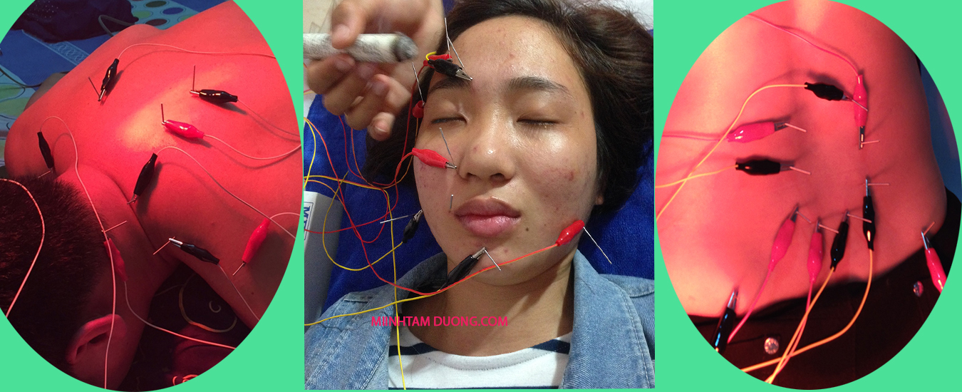 dich-vu-cham-cuu-tai-nha-van-mieu-dong-da-ha-noi-2