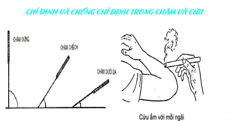 cham-cuu-tai-nha-hang-bac-hoan-kiem-ha-noi dich-vu-cham-cuu-tai-nha-hang-bac-hoan-kiem-ha-noi