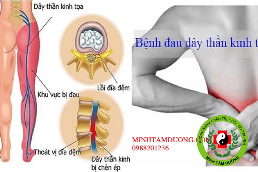 bam-huyet-tai-nha-tai-cat-linh dich-vu-bam-huyet-tai-nha-tai-cat-linh