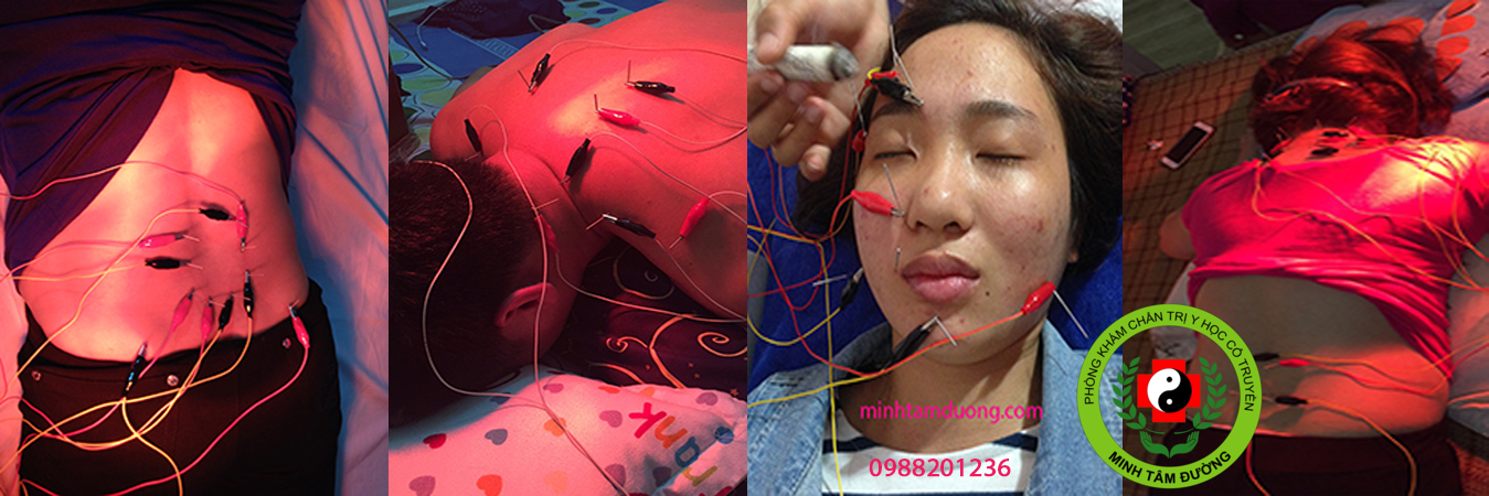 cham-cuu-tai-nha-nguyen-du  dich-vu-cham-cuu-tai-nha-nguyen-du-ha-noi-chat-luong-gia-re