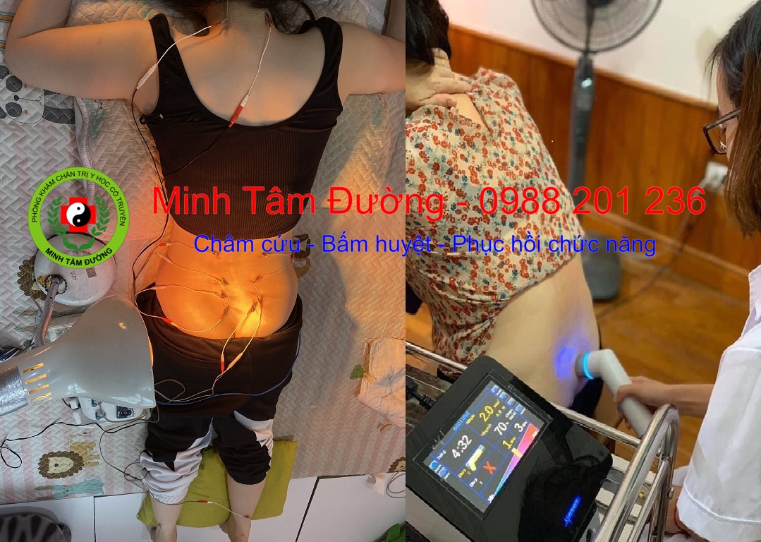 cham-cuu-tai-nha-tran-hung-dao dich-vu-cham-cuu-tai-nha-tran-hung-dao-ha-noi-2