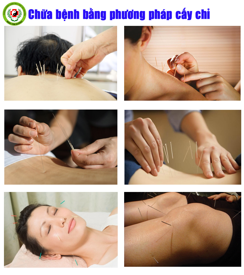 dich-vu-xoa-bop-bam-huyet-tai-nha-dien-bien