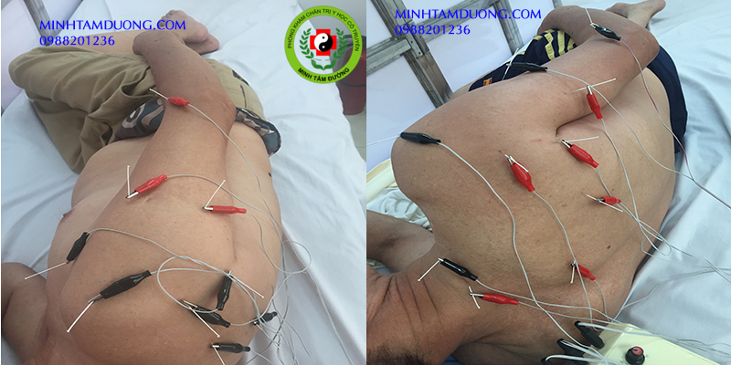 dich-vu-cham-cuu-tai-nha-phan-chu-trinh-ha-noi-2