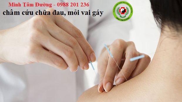cham-cuu-tai-nha-phan-chu-trinh-ha-noi dich-vu-cham-cuu-tai-nha-phan-chu-trinh-ha-noi-2
