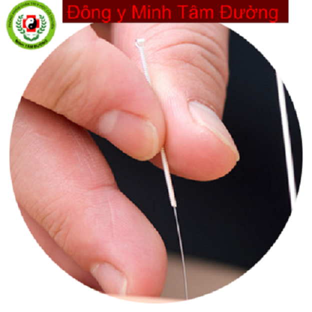 cham-cuu-tai-nha-dong-nhan-ha-noi-2 dich-vu-cham-cuu-tai-nha-dong-nhan-ha-noi-2
