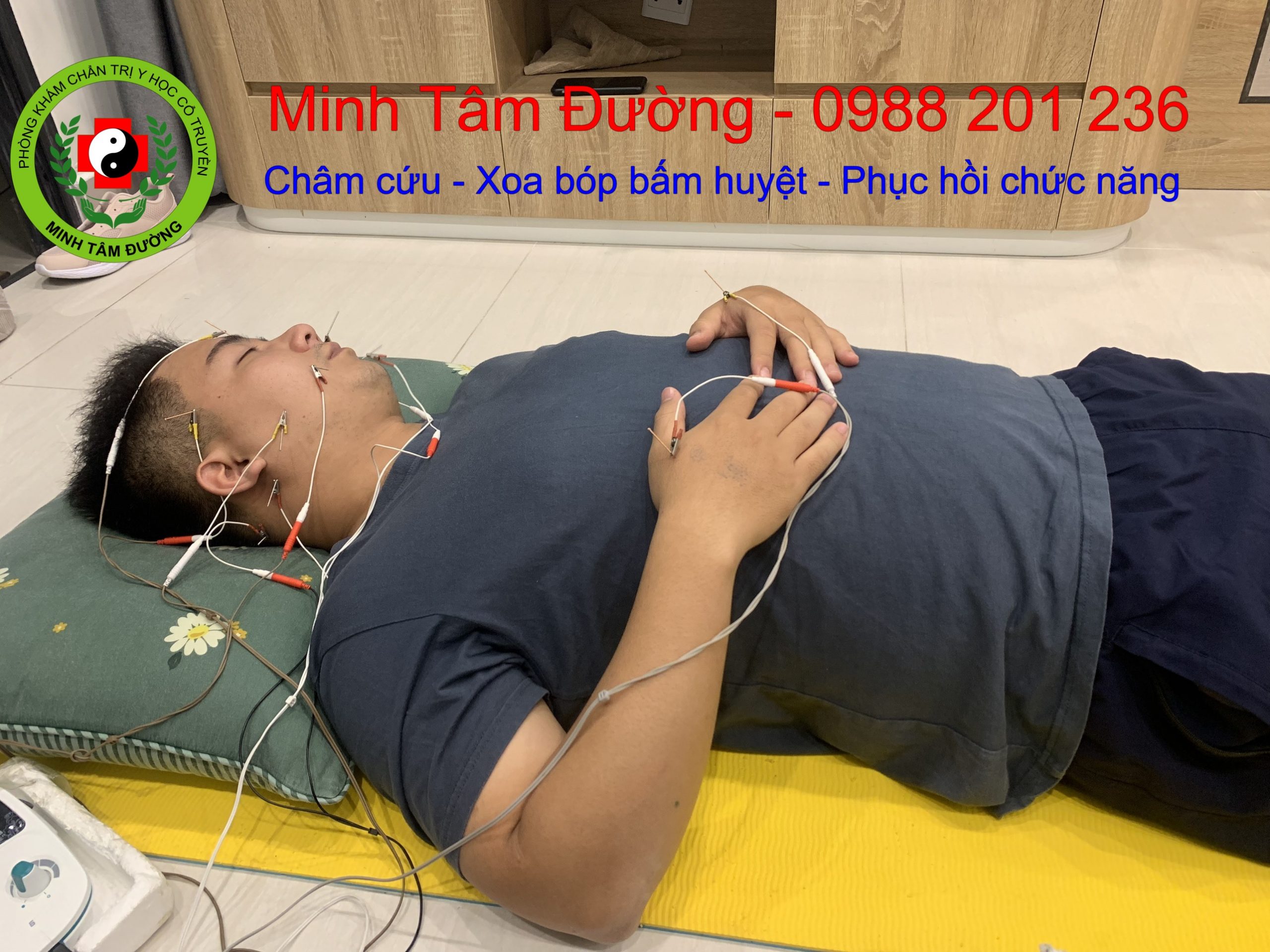 cham-cuu-tai-nha-bach-dang-ha-noi-2 dich-vu-cham-cuu-tai-nha-bach-dang-ha-noi-2
