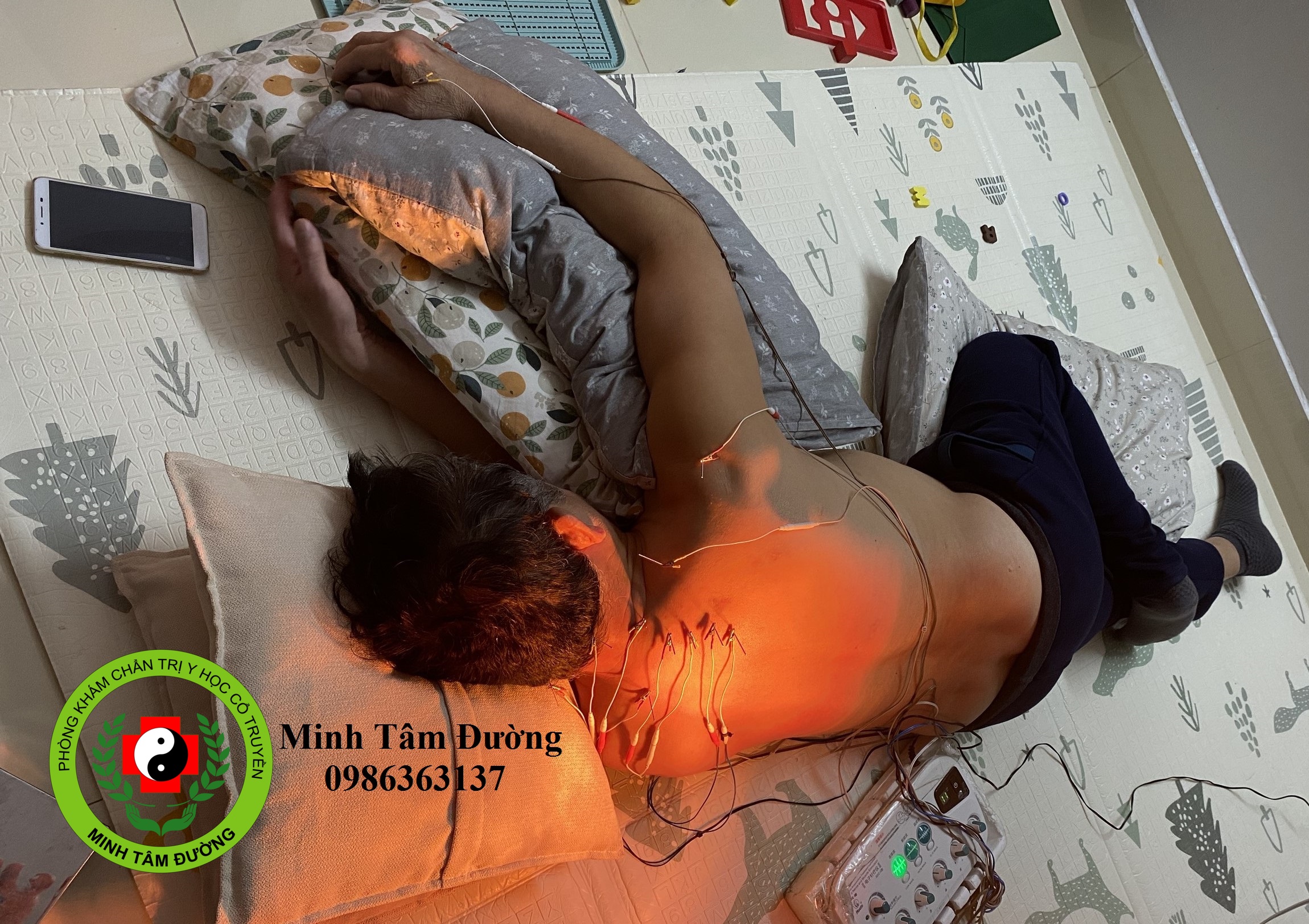 cham-cuu-tai-nha-thanh-nhan dich-vu-cham-cuu-tai-nha-thanh-nhan-ha-noi-2