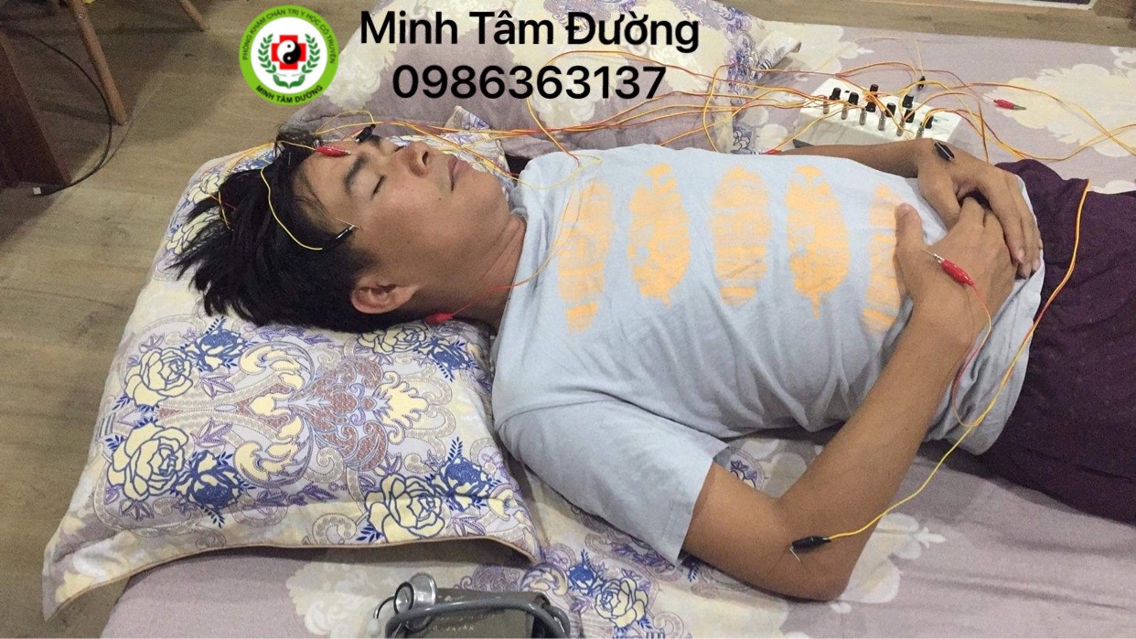 cham-cuu-tai-nha-khu-vuc-ha-noi châm cứu tại nhà khu vực hà nội