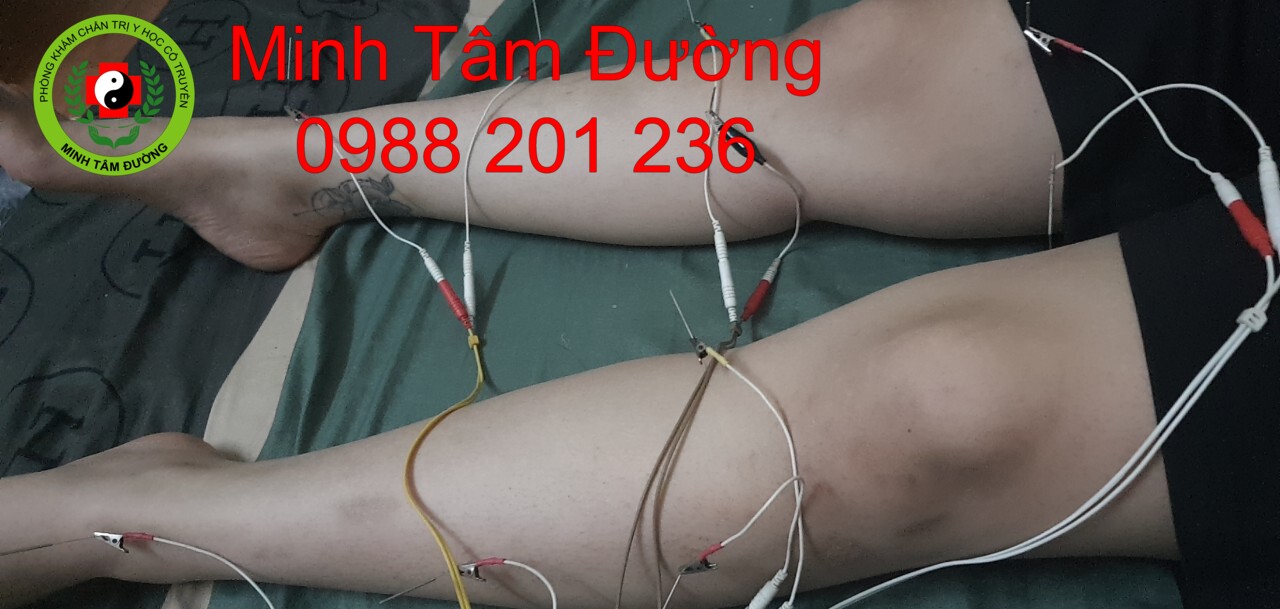 cham-cuu-tai-nha-thanh-nhan dich-vu-cham-cuu-tai-nha-thanh-nhan-ha-noi-2