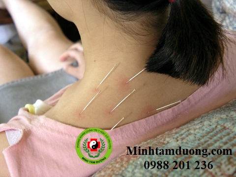 cham-cuu-tai-nha-le-dai-hanh dich-vu-cham-cuu-tai-nha-le-dai-hanh-ha-noi-2