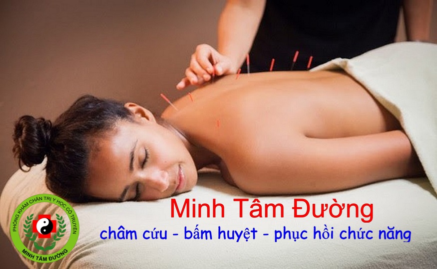 cham-cuu-tai-nha-bui-thi-xuan-ha-noi-2 dich-vu-cham-cuu-tai-nha-bui-thi-xuan-ha-noi-2