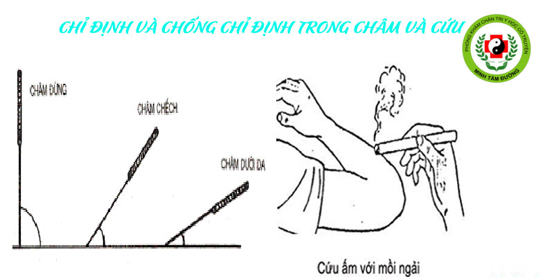 cham-cuu-tai-nha-le-dai-hanh dich-vu-cham-cuu-tai-nha-le-dai-hanh-ha-noi-2