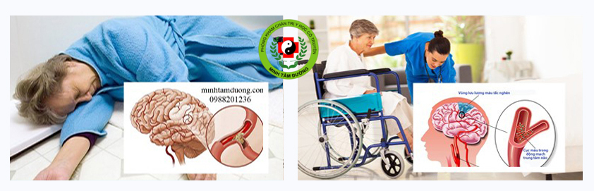 phuc-hoi-chuc-nang-tai-nha-linh-nam dich-vu-phuc-hoi-chuc-nang-tai-nha-linh-nam