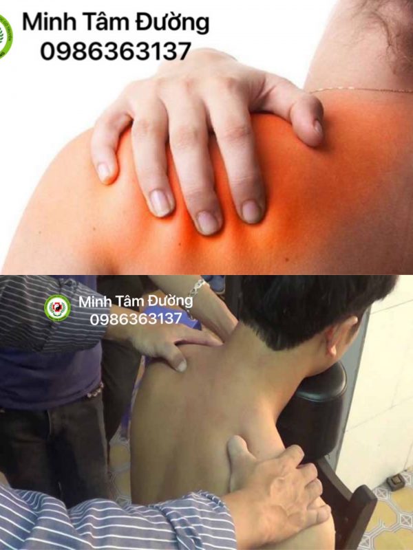 bam-huyet-tai-nha-tai-ngoc-thuy-long-bien