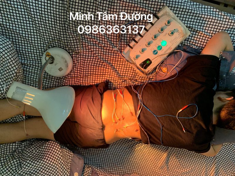 cham-cuu-bam-huyet-tai-nha-tai-dong-ngac