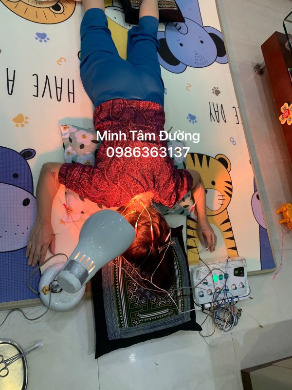 cham-cuu-bam-huyet-tai-nha-tai-dong-ngac