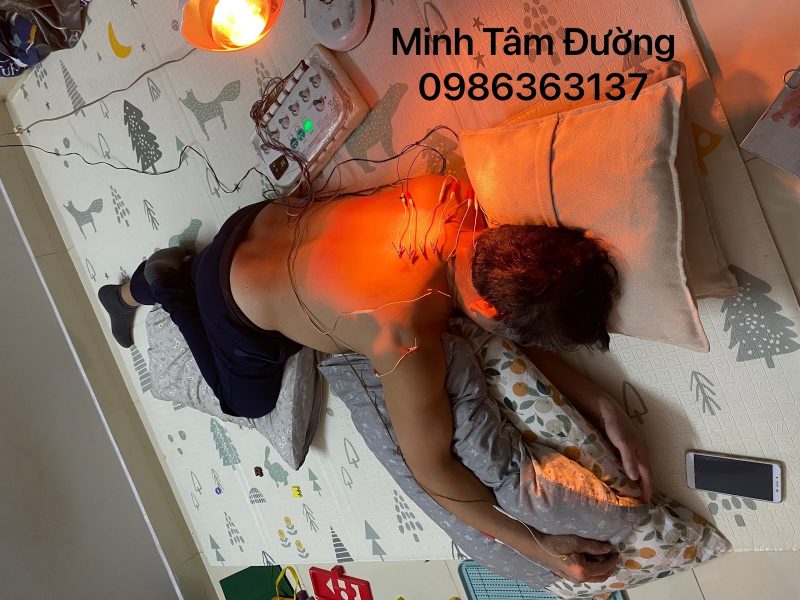 cham-cuu-bam-huyet-tai-nha-tai-me-tri