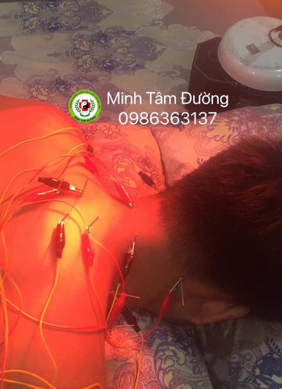 cham-cuu-tai-nha-tai-dong-mai