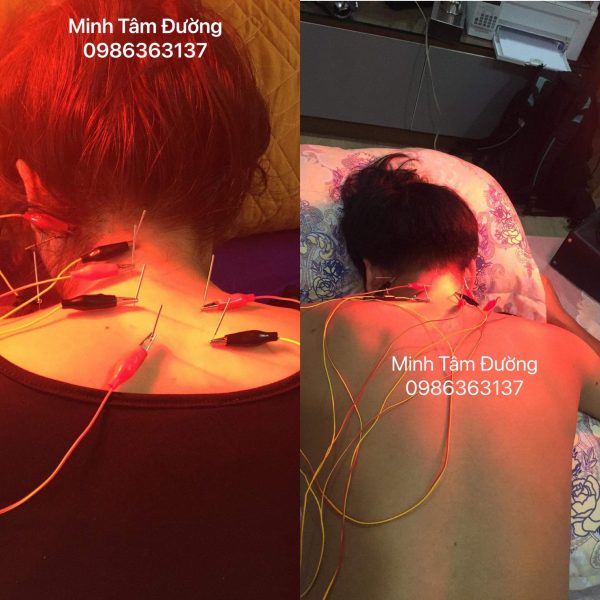 cham-cuu-tai-nha-tai-dong-mai