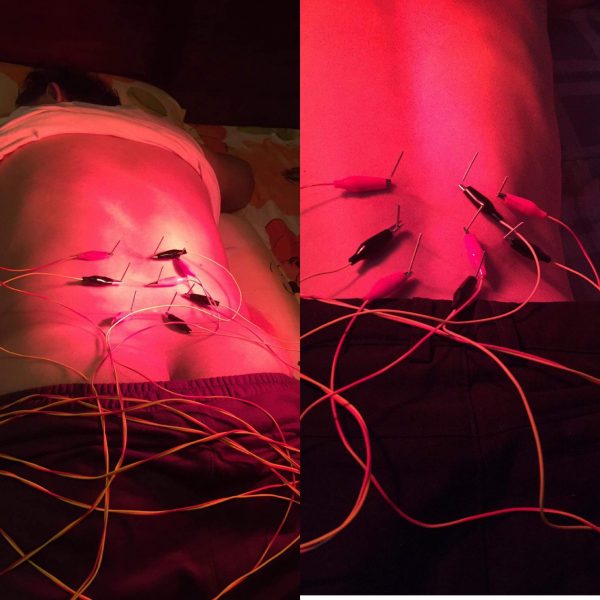 cham-cuu-tai-nha-tai-dong-mai