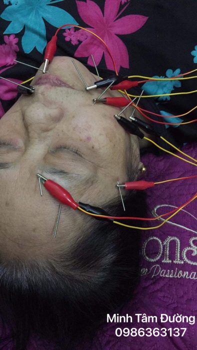 cham-cuu-tai-nha-tai-giap-bat