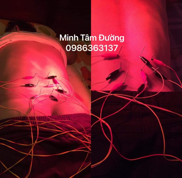 cham-cuu-tai-nha-tai-ngoc-thuy-long-bien