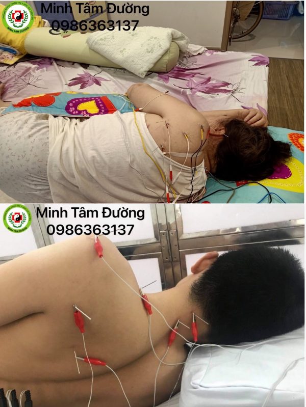 cham-cuu-tai-nha-tai-phuc-tan