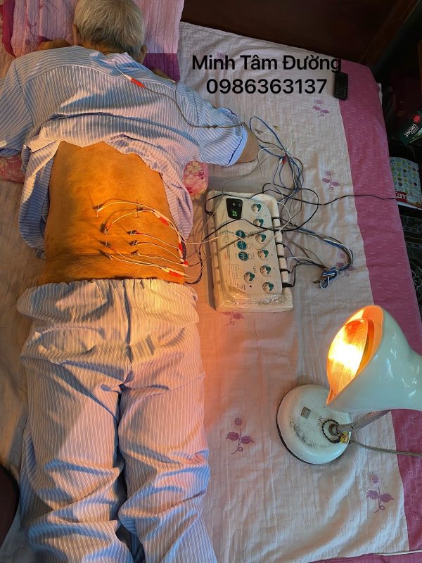 cham-cuu-tai-nha-tai-tay-mo 