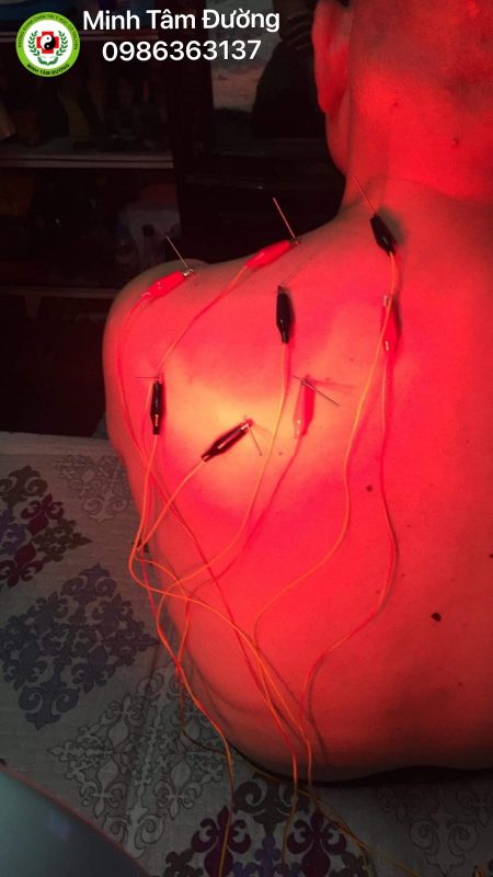 cham-cuu-tai-nha-tai-thanh-cong-ba-dinh cham-cuu-tai-nha-tai-thanh-cong-ba-dinh