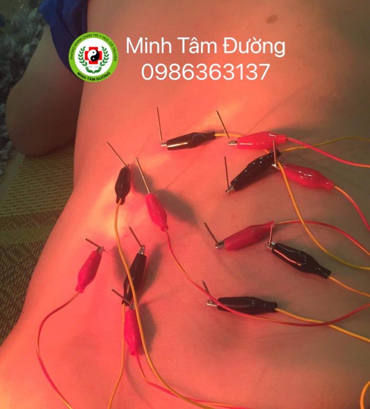 cham-cuu-tai-nha-tai-thanh-cong-ba-dinh