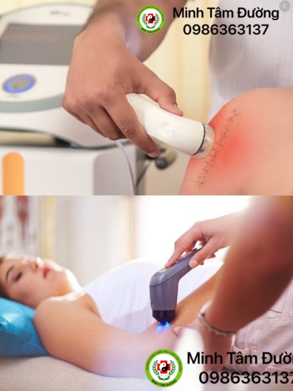 vat-ly-tri-lieu-tai-nha-tai-ngoc-thuy-long-bien