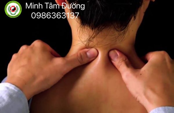 bam-huyet-tai-nha-tai-tay-son-dong-da