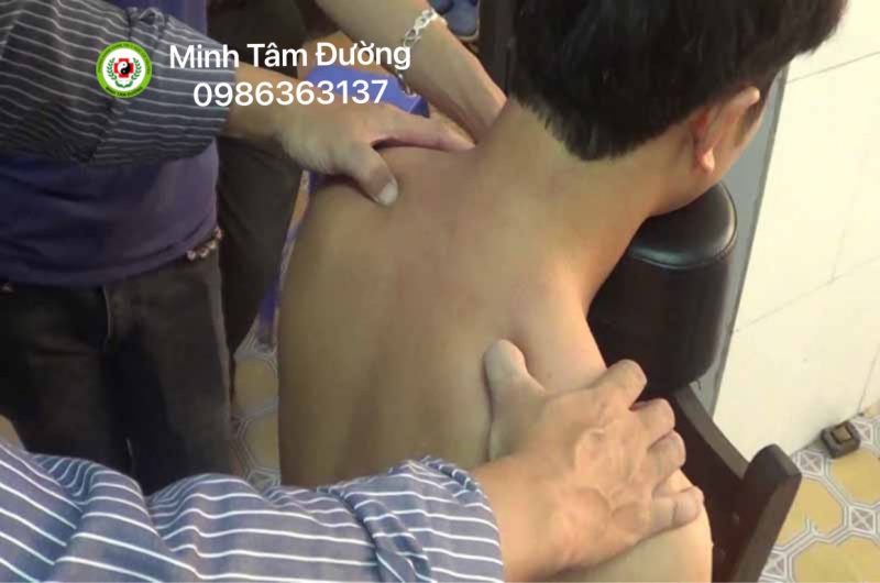 bam-huyet-tai-nha-xuan-dinh 