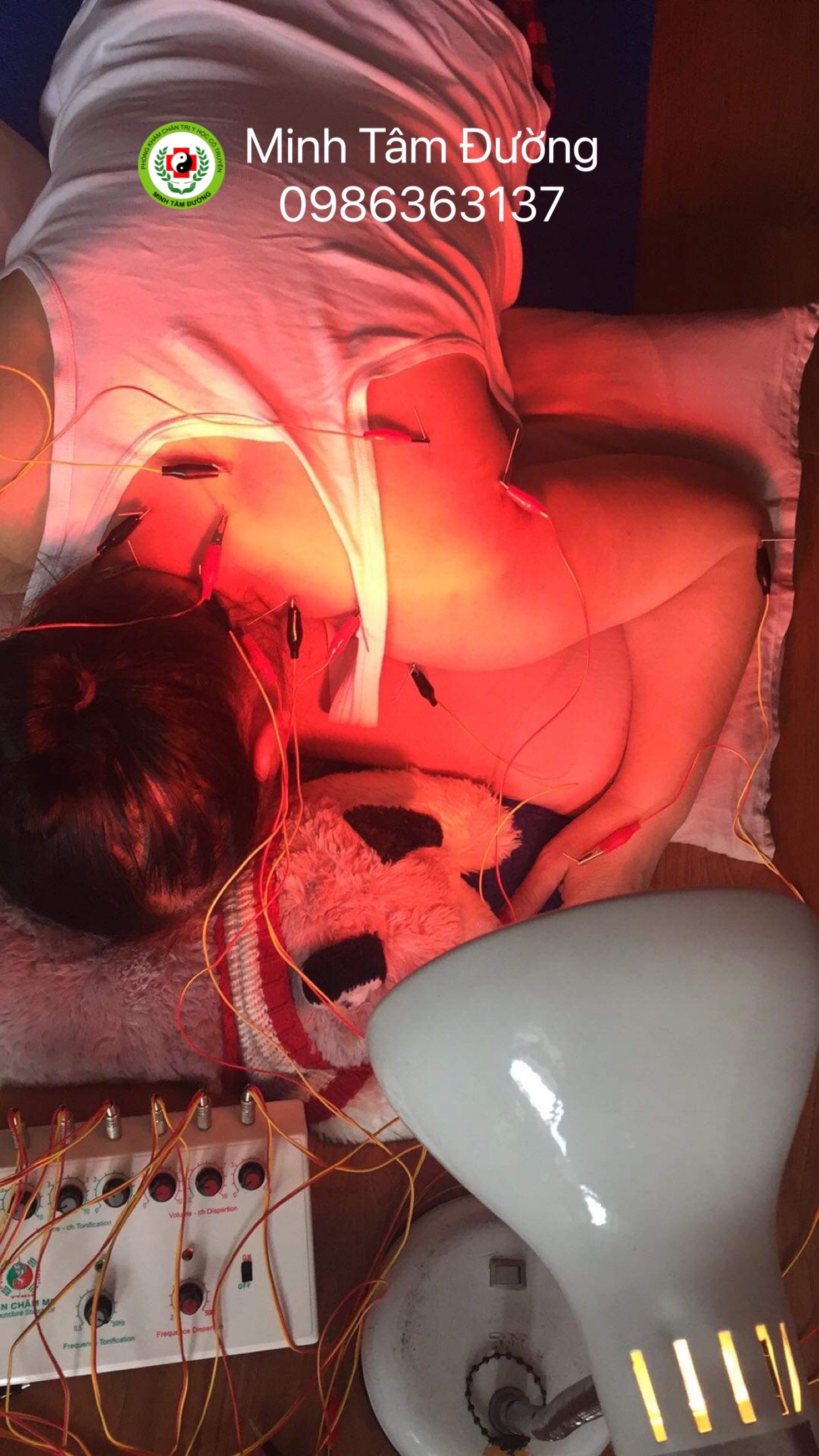 cham-cuu-bam-huyet-tai-nha-tai-mai-dich-cau-giay