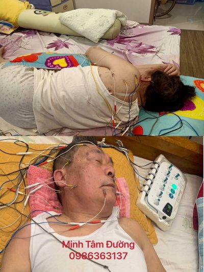 cham-cuu-bam-huyet-tai-nha-tai-tay-son-dong-da