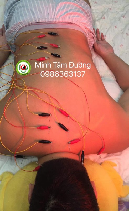 cham-cuu-tai-nha-tai-ha-cau