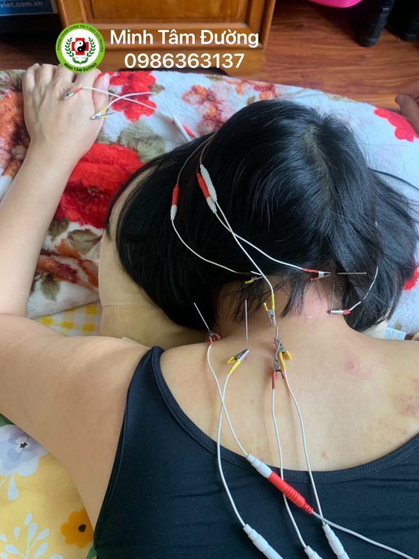 cham-cuu-tai-nha-tai-ha-cau