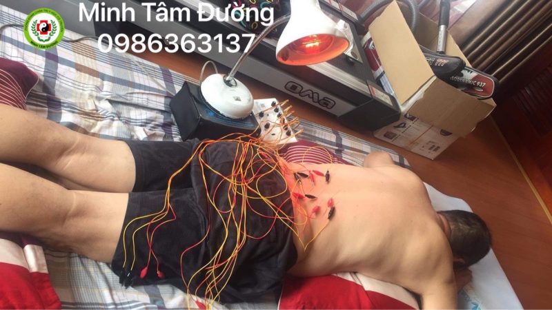 cham-cuu-tai-nha-tai-ha-cau