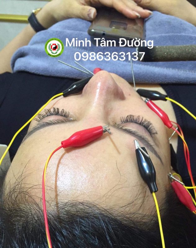 phuc-hoi-chuc-nang-tai-nha-tai-nghia-do-cau-giay 