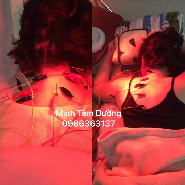 phuc-hoi-chuc-nang-tai-nha-tai-nghia-do-cau-giay 